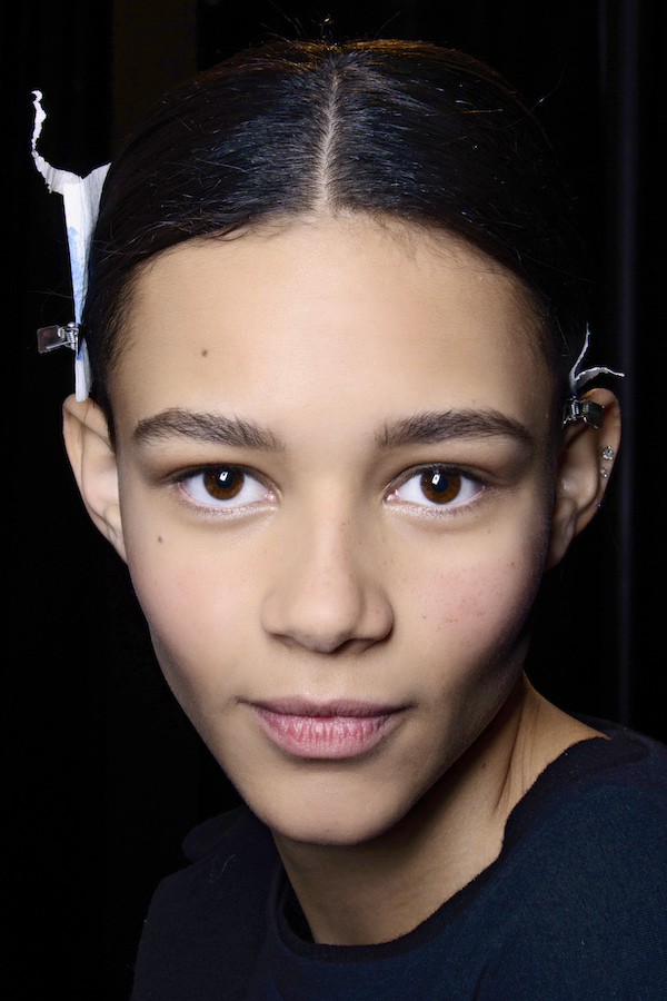 10 Things You Need To Know About Hormonal Acne