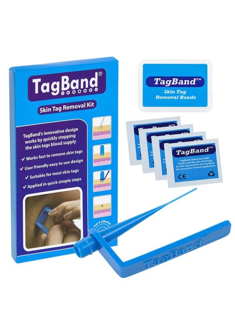 TagBand Skin Tag Removal Device
