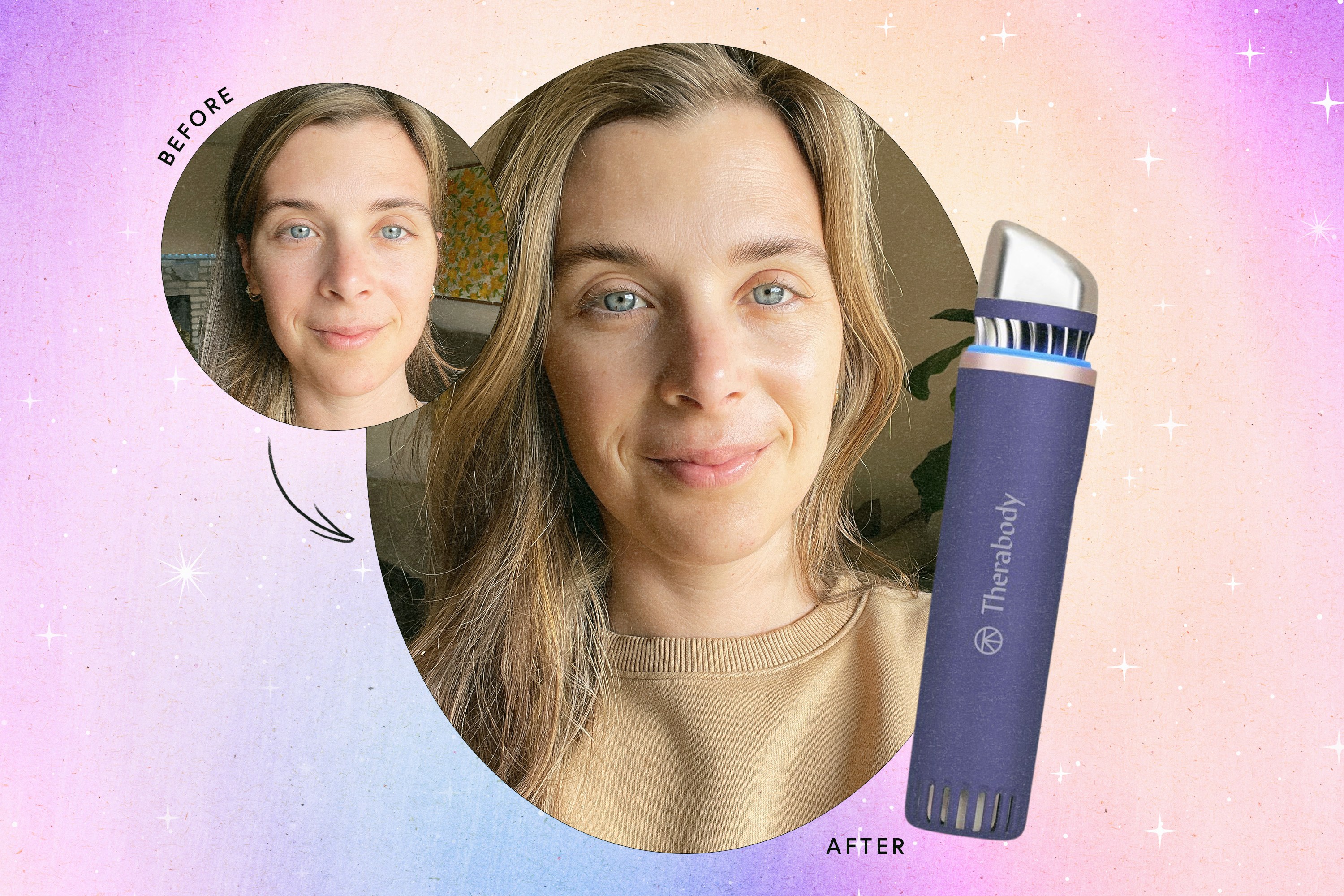 Before and after photos of Jessie using the TheraFace Depuffing Wand